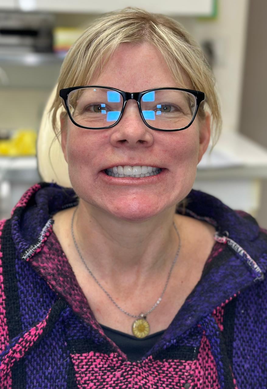 Patient smile result