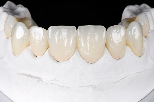 Cosmetic Dentistry