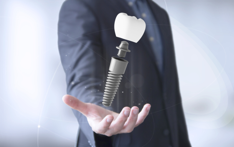 Dental Implants