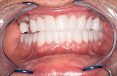 after front kims chell