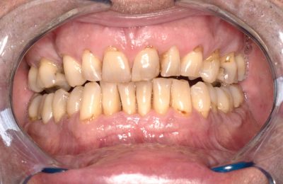 before front kims chell