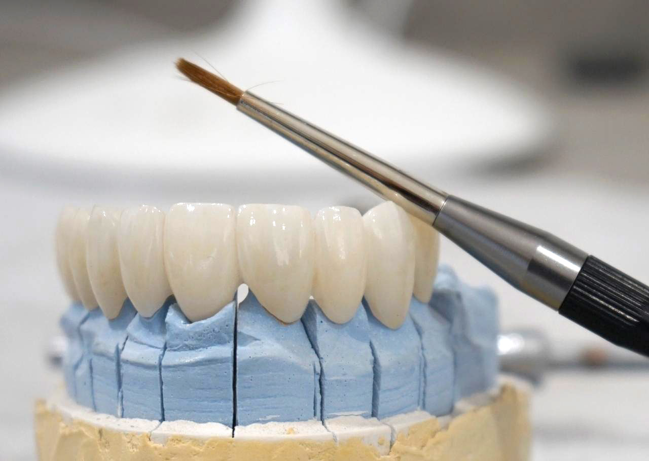 Dental Crowns Dental Crowns